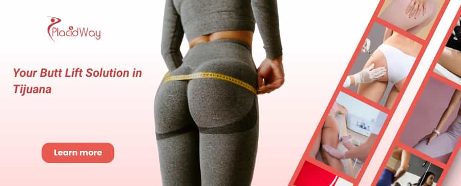 Levantamiento de glúteos brasileño en Tijuana, México: tu solución para el levantamiento de glúteos thumbnail