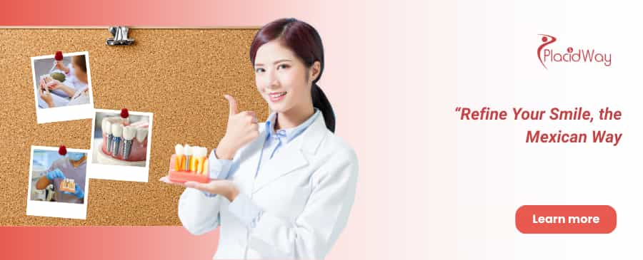 Implantes dentales All on 8 en Tijuana - Tratamiento dental asequible en México thumbnail