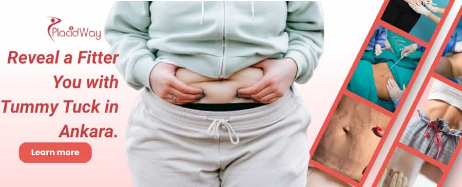 Abdominoplastia en Ankara, Turquía thumbnail