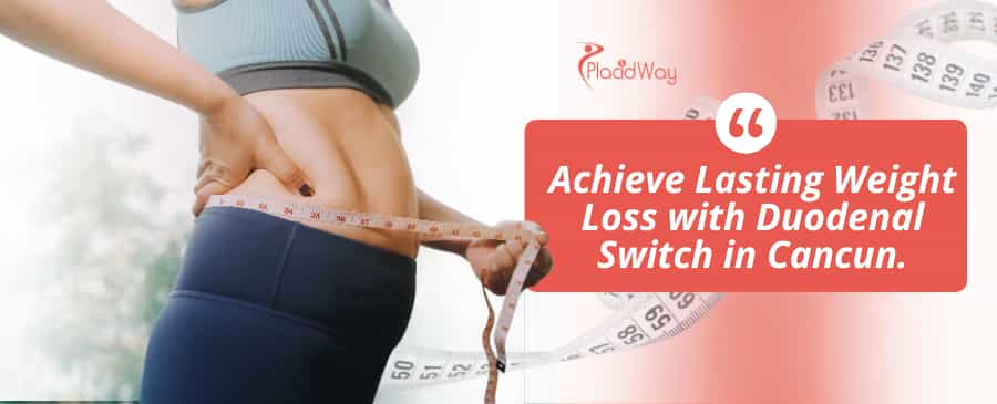 Cirugía de cruce duodenal en Cancún, México thumbnail