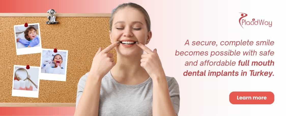Implantes dentales de boca completa en Turquía: asequibles y seguros thumbnail