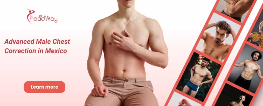Ginecomastia Guadalajara, México thumbnail