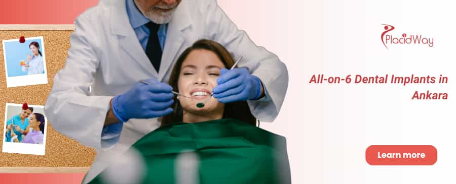 Implantes All-on-6 Ankara, Turquía thumbnail