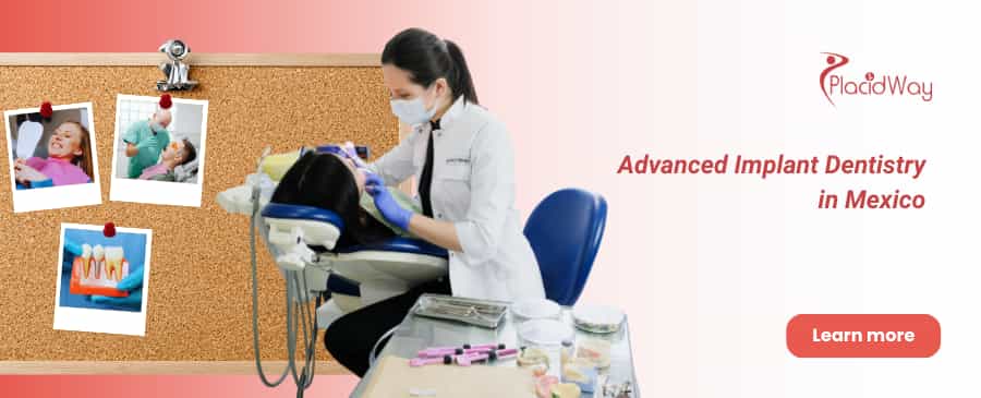 Implantes dentales All on 6 en Cancún, México thumbnail