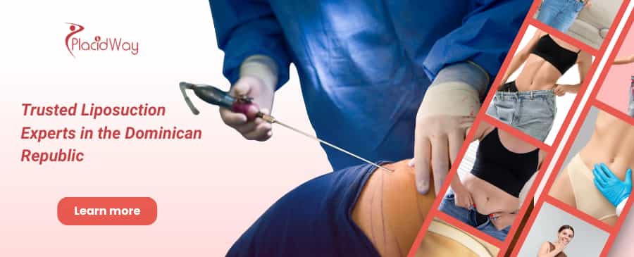 Liposucción en Santo Domingo, República Dominicana thumbnail