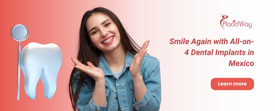 Implantes dentales All on 4 en México thumbnail