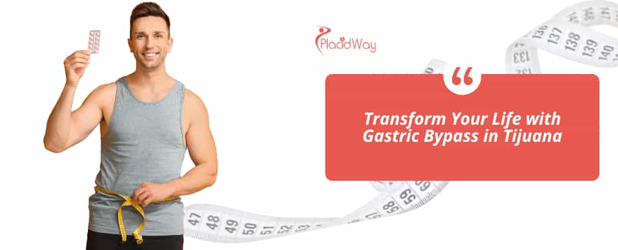 Bypass gástrico en Tijuana, México thumbnail