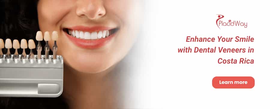 Carillas dentales en Costa Rica thumbnail