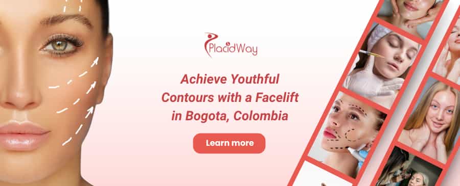 Lifting facial en Bogotá, Colombia thumbnail
