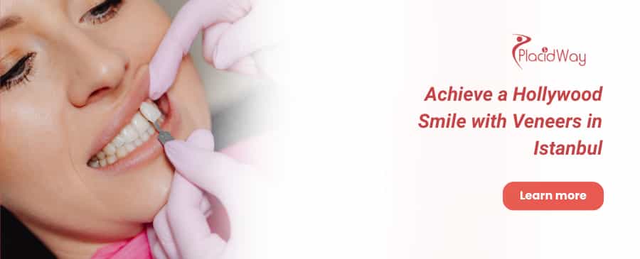 Carillas dentales en Estambul thumbnail