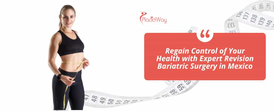 Cirugía Bariátrica de Revisión en México  thumbnail