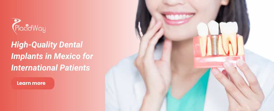 Implantes dentales en México thumbnail