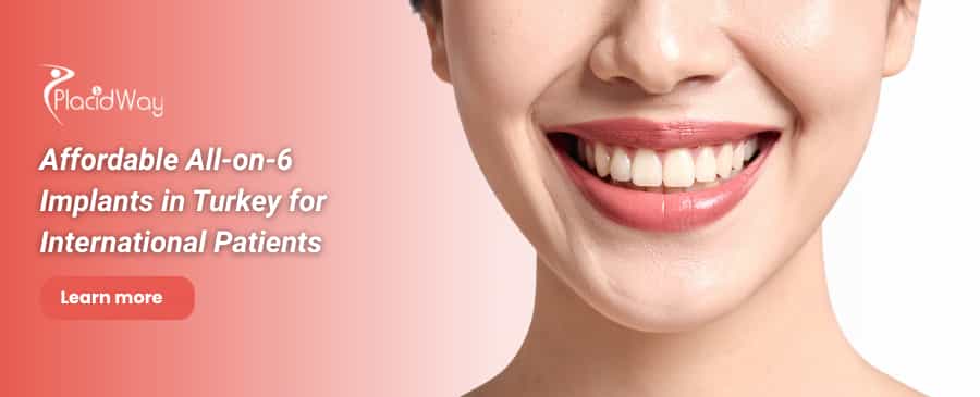 Implantes dentales All on 6 en Turquía thumbnail