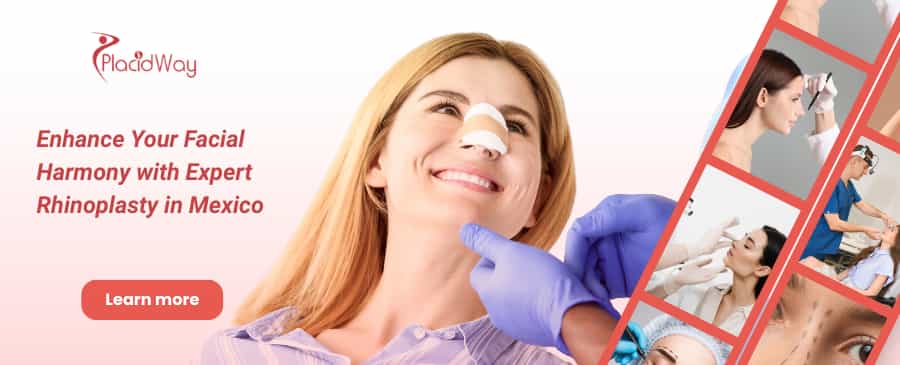 Rinoplastia en Mérida, México thumbnail