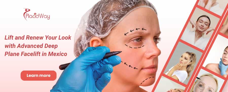 Lifting facial profundo en México thumbnail