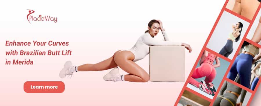 Levantamiento de glúteos brasileño en Mérida, México thumbnail