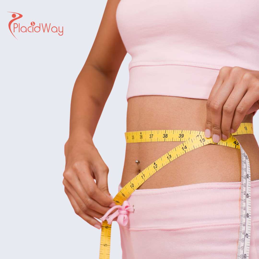 Cirugía bariátrica en Turquía para residentes de Ontario