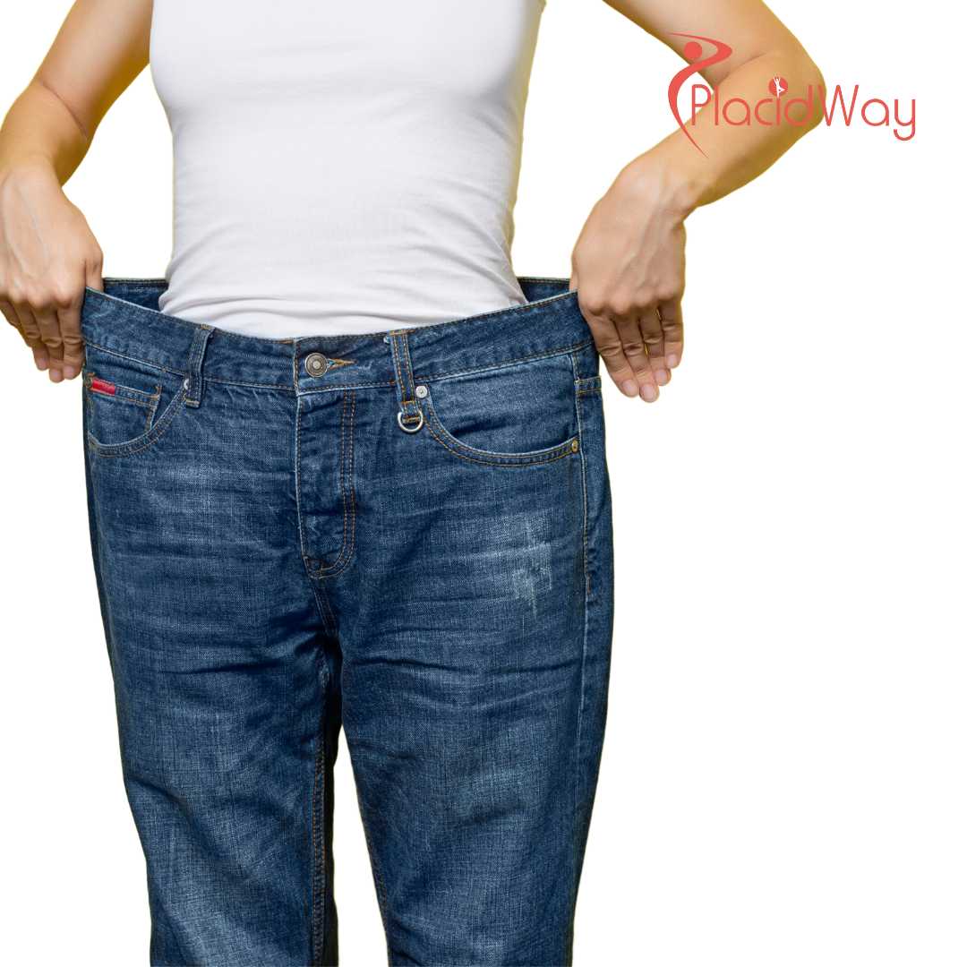 Cirugía de manga gástrica en Turquía para una pérdida de peso sostenible y una mejora de la salud.