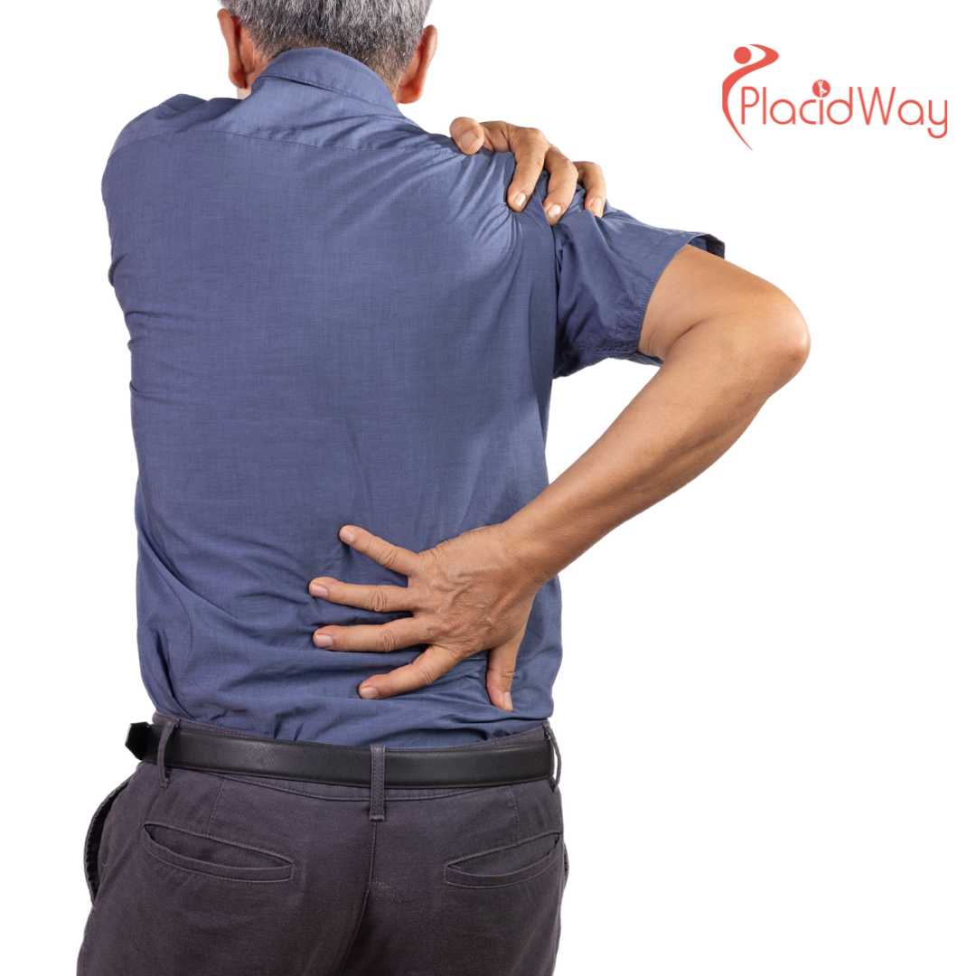 7 razones principales para someterse a una cirugía del manguito rotador en Turquía