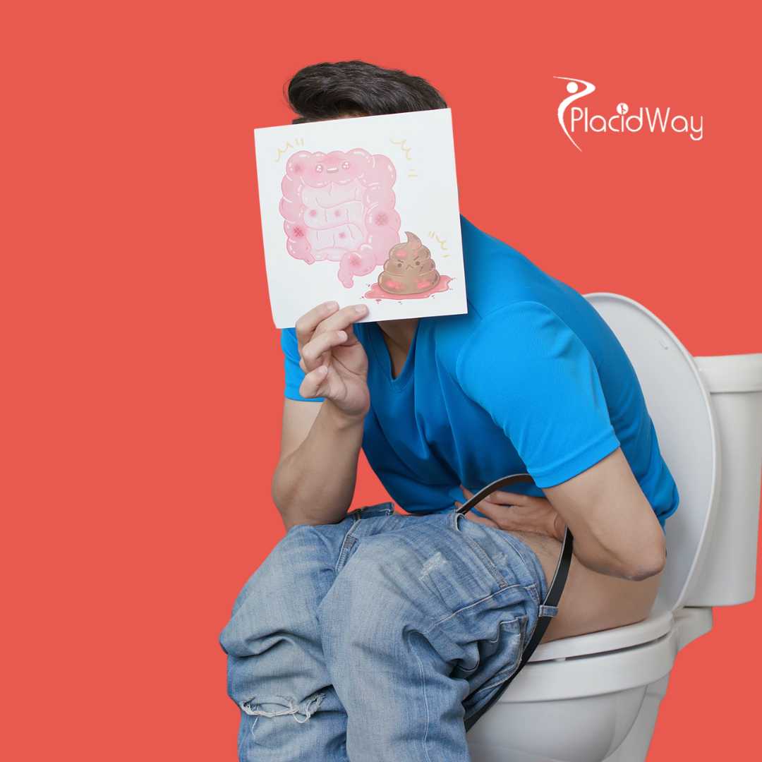 Cáncer colorrectal en México: Cómo las inmunoterapias y las opciones alternativas están cambiando vidas