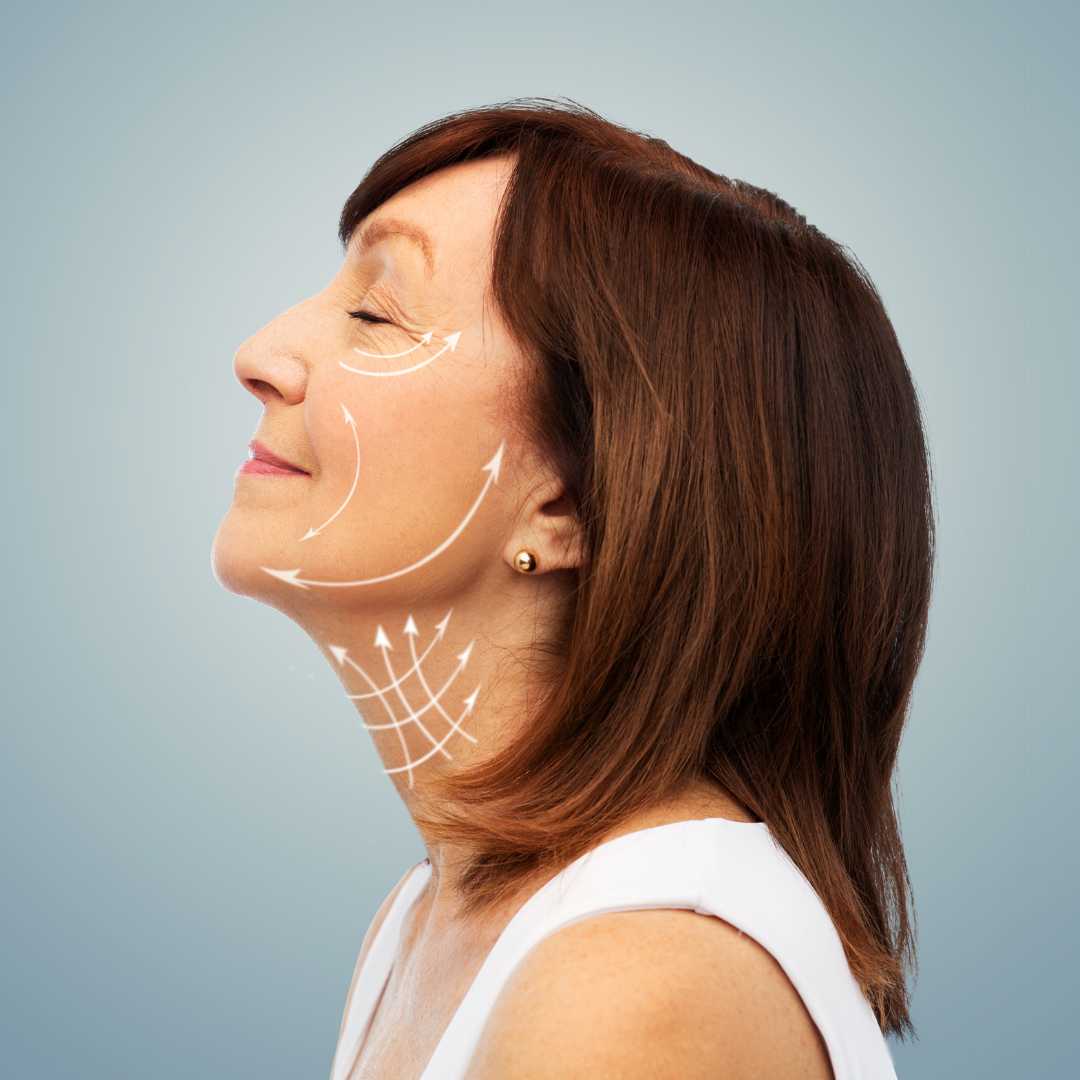 Lifting facial en México: recupere su apariencia juvenil
