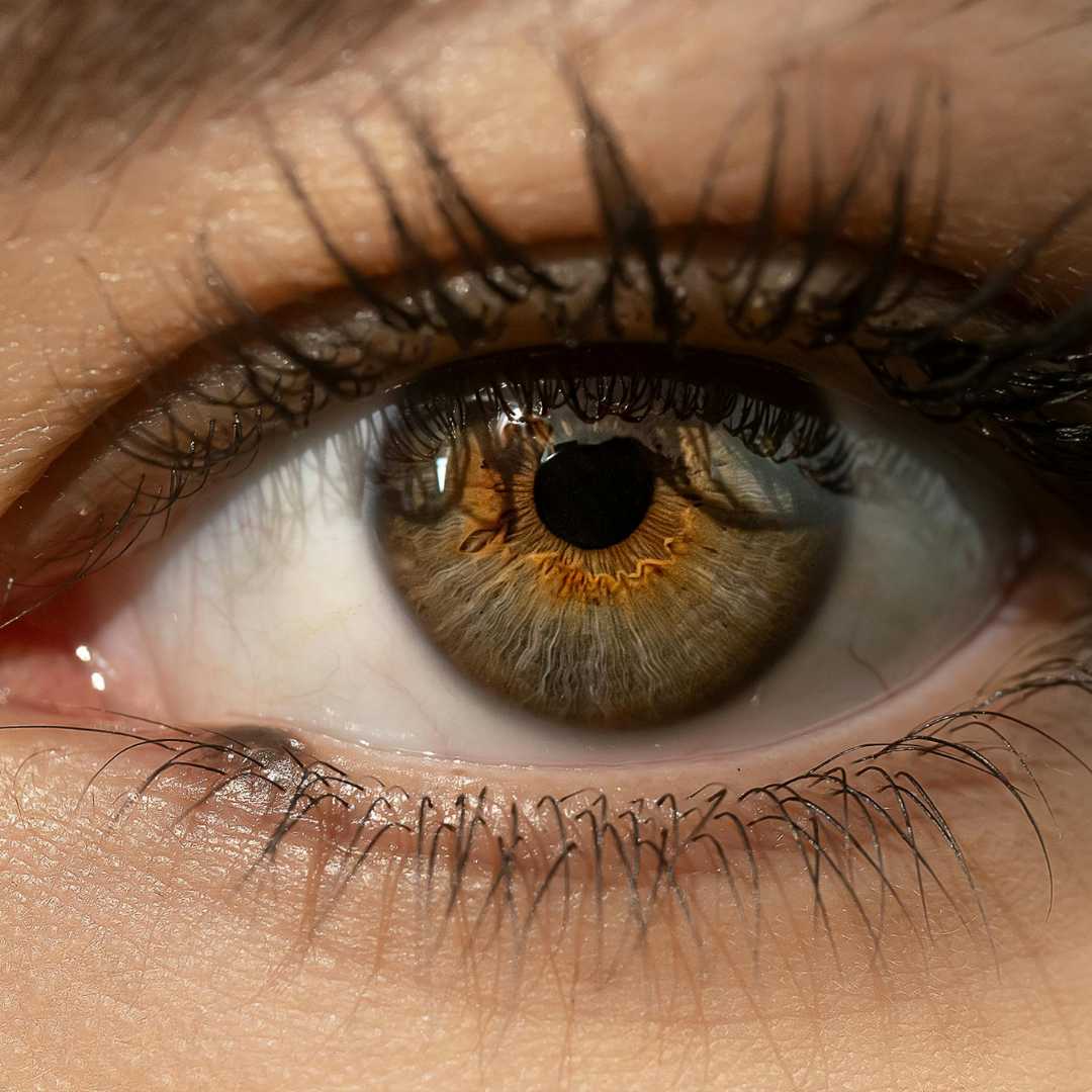 Cirugía ocular Lasik en Cancún, México