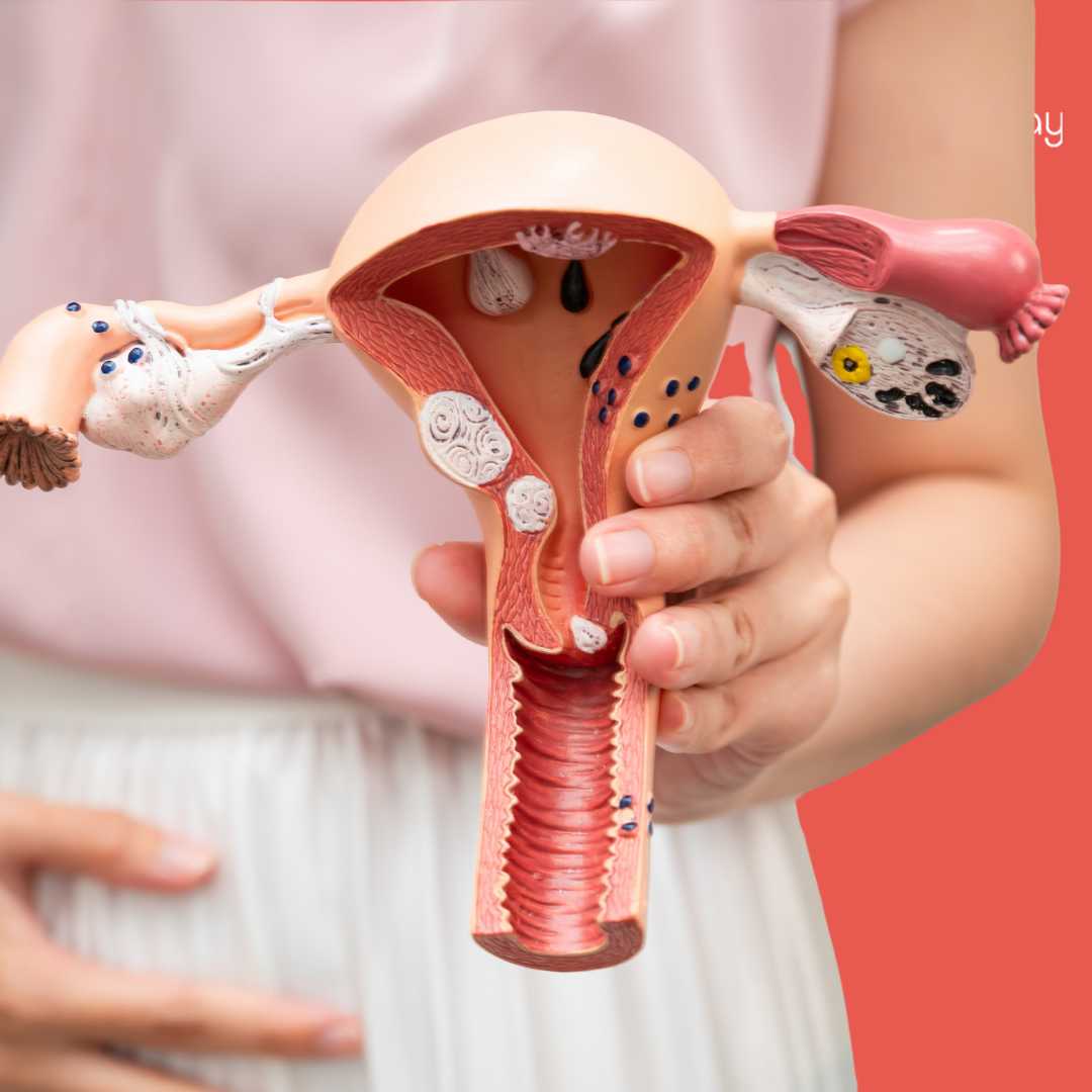 Tratamiento ginecológico en Turquía