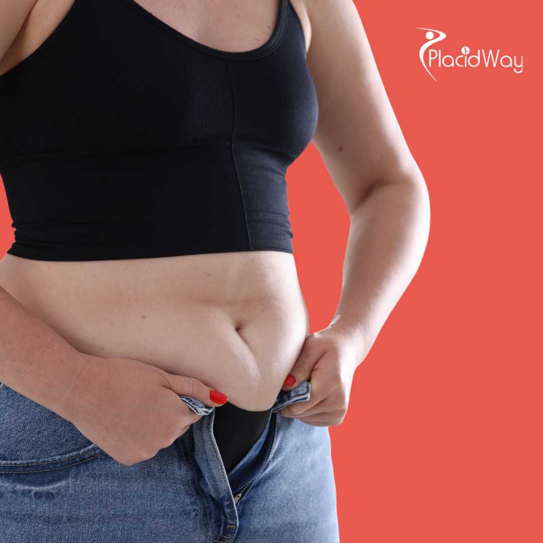 Liposucción en Estambul, Turquía