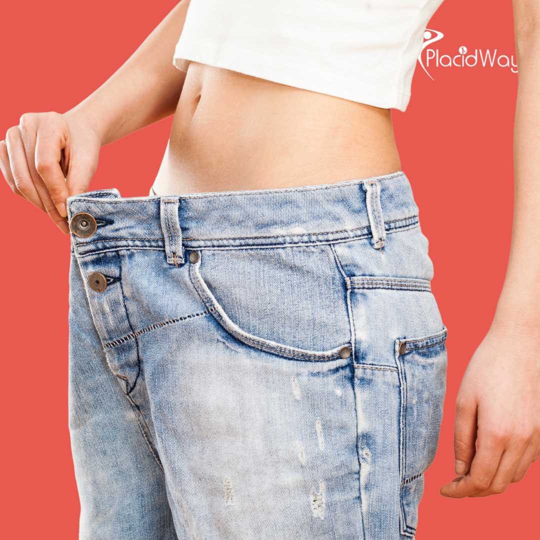 Bypass Gástrico en Mexicali, México