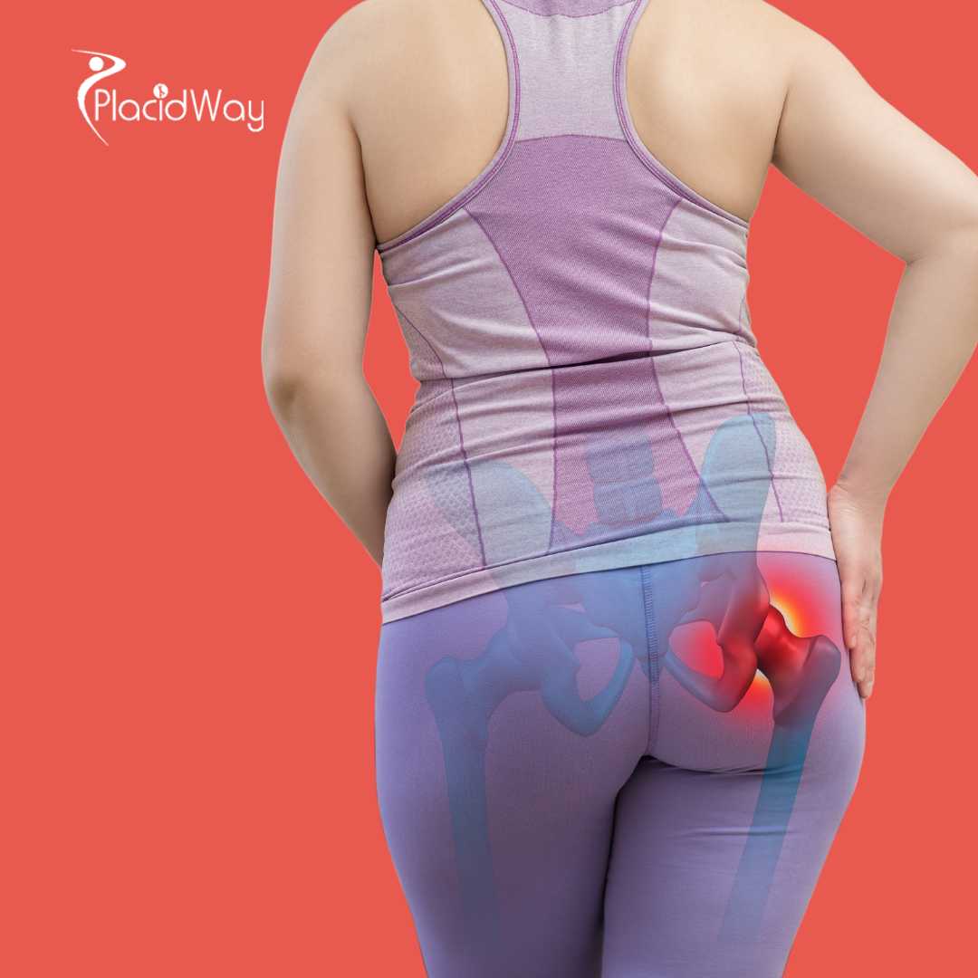 Reemplazo de Cadera en Tijuana - Mejore la Salud de su Cadera