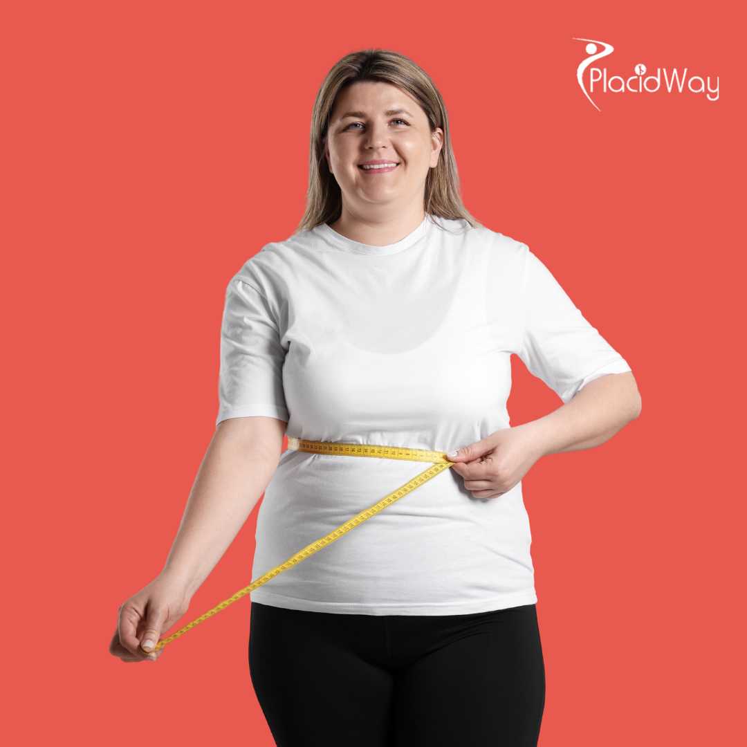 Cirugía de Manga Gástrica en Tijuana, México