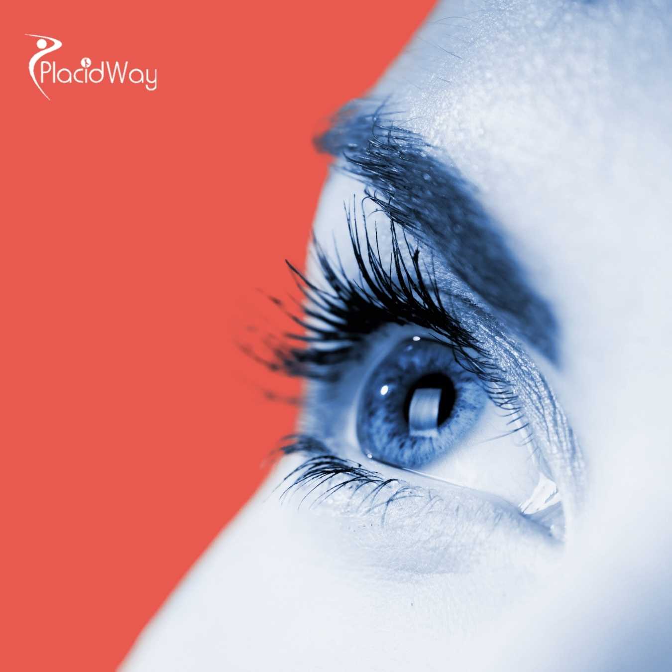 Cirugía Lasik en México