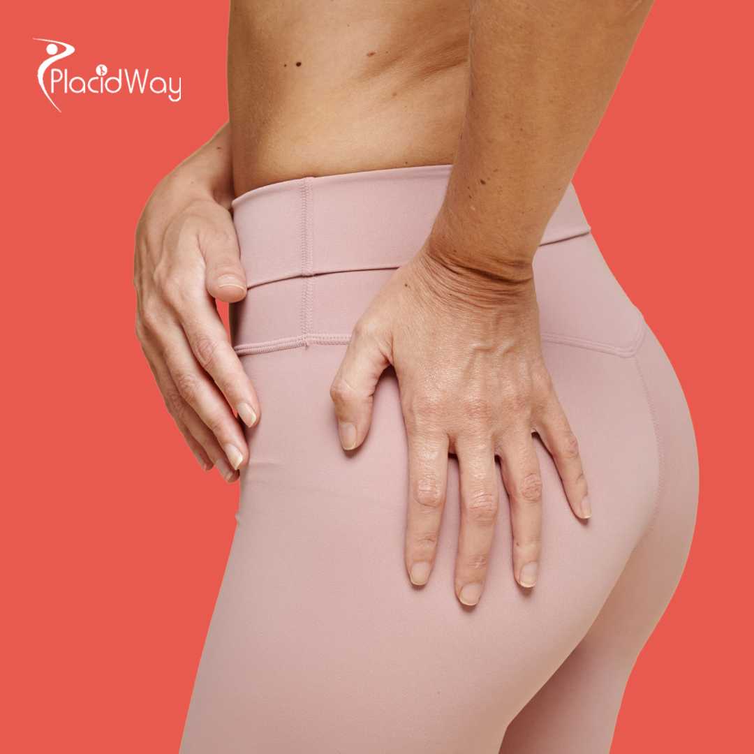 Levantamiento de glúteos brasileño en Costa Rica: elija BBL en Costa Rica