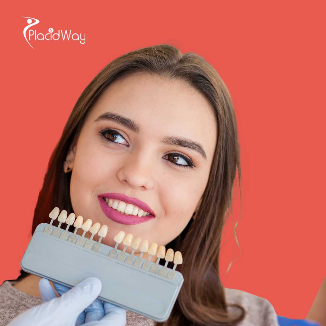 Implantes dentales en San José, Costa Rica