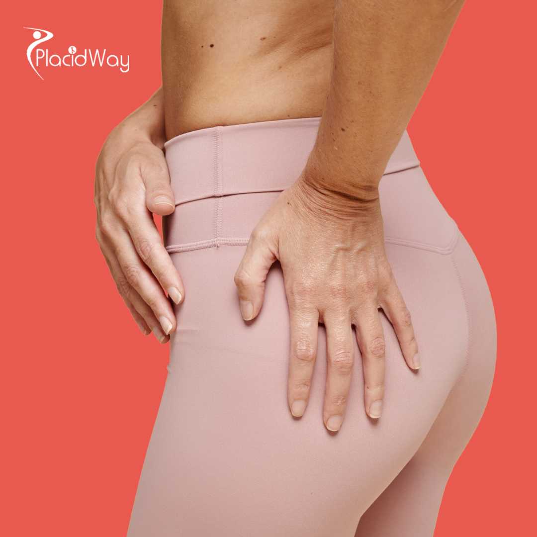 Levantamiento de glúteos brasileño en Ciudad de México, México