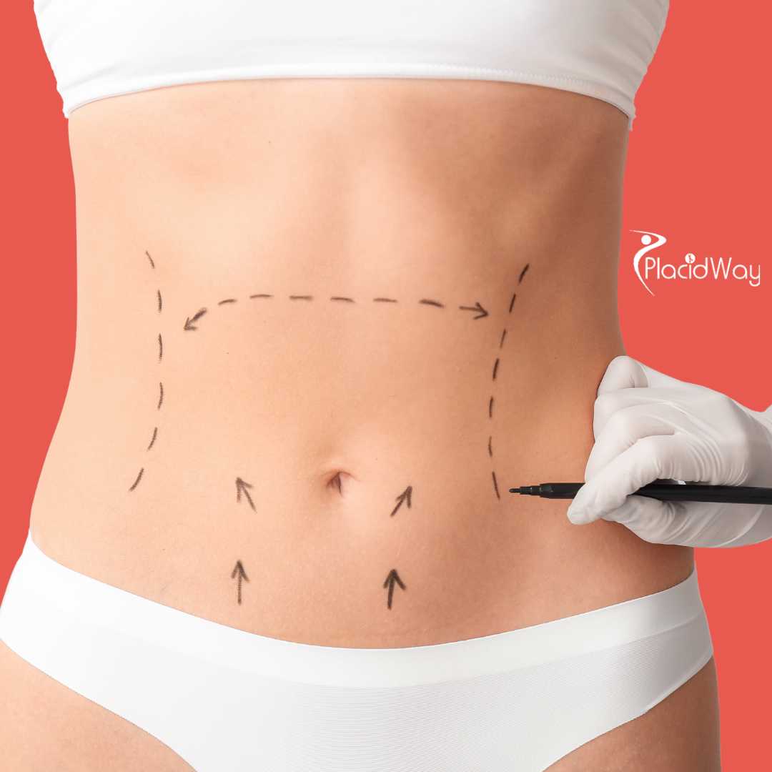 Cambio de imagen para mamás en Antalya, Turquía