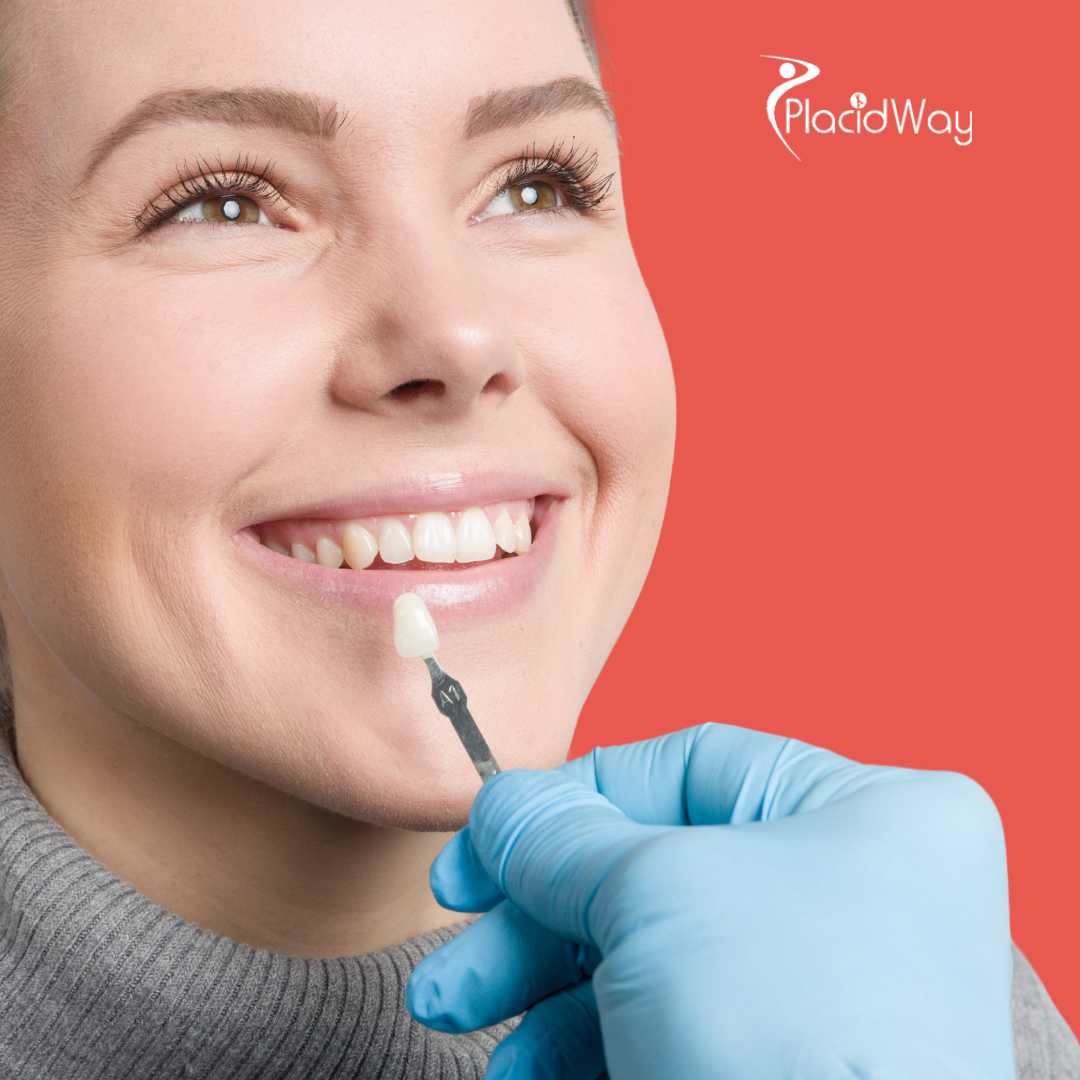 Carillas dentales en Izmir, Turquía