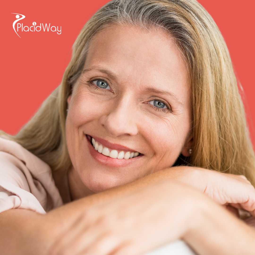 Implantes dentales All on 4 en Tijuana, México | Ahorra 80%