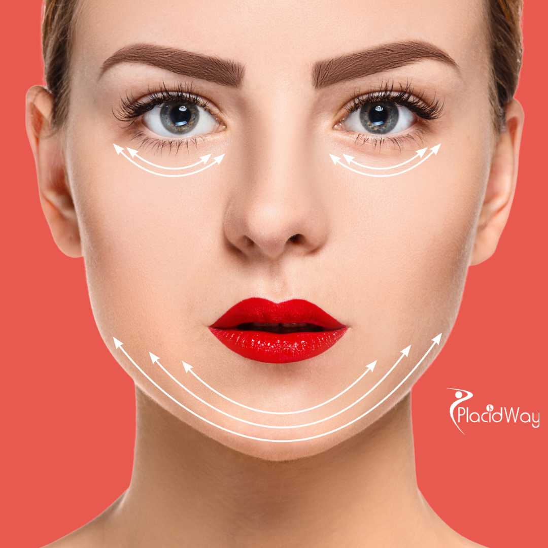 Rejuvenecimiento facial en Tijuana, México