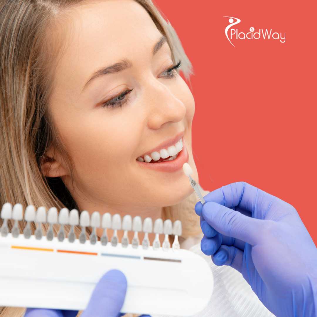 Carillas dentales en Puerto Vallarta México