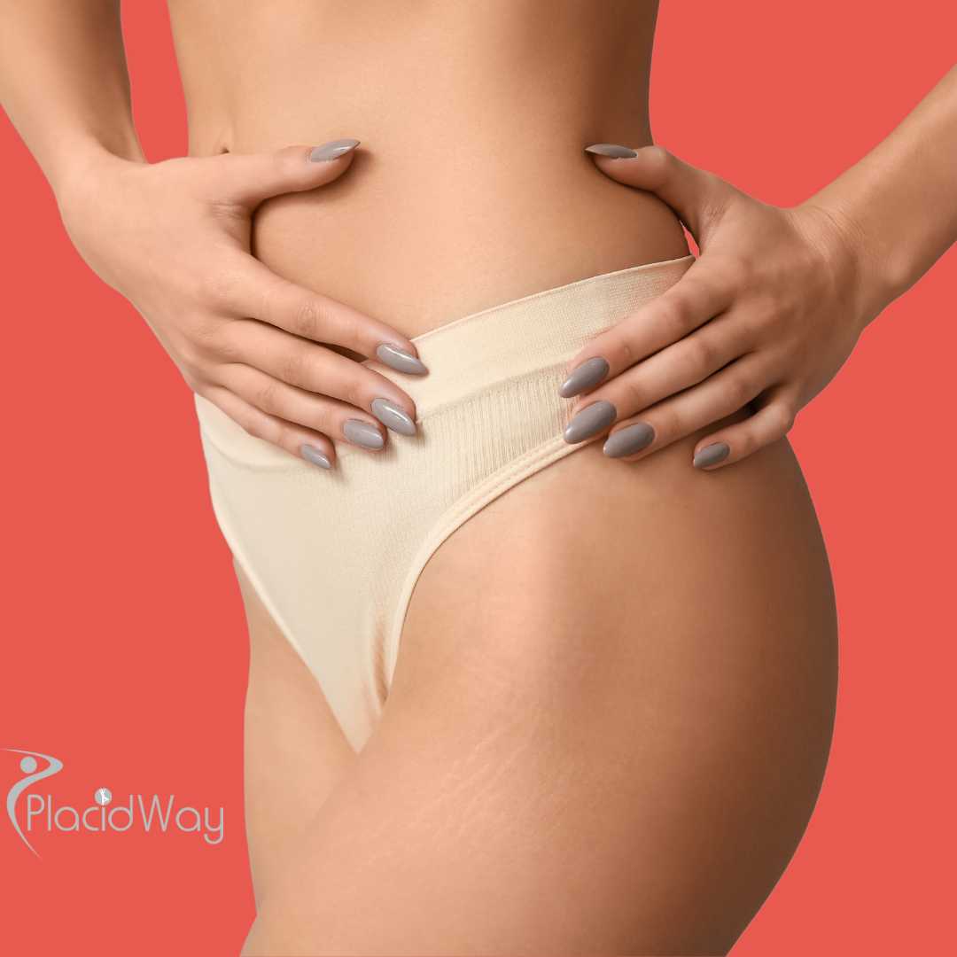 Mommy Makeover en Cancún, México