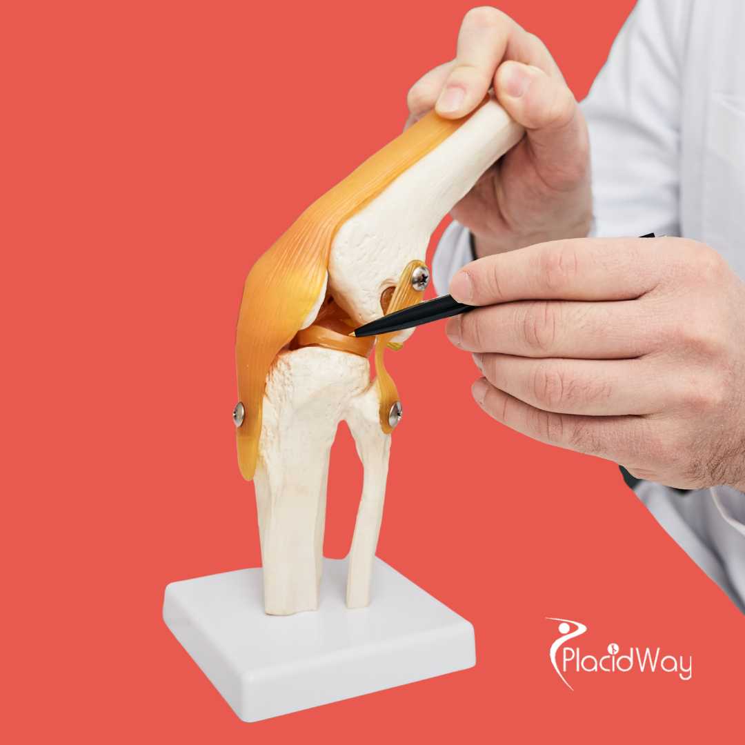 Reparación de desgarro de menisco en Puerto Vallarta, México