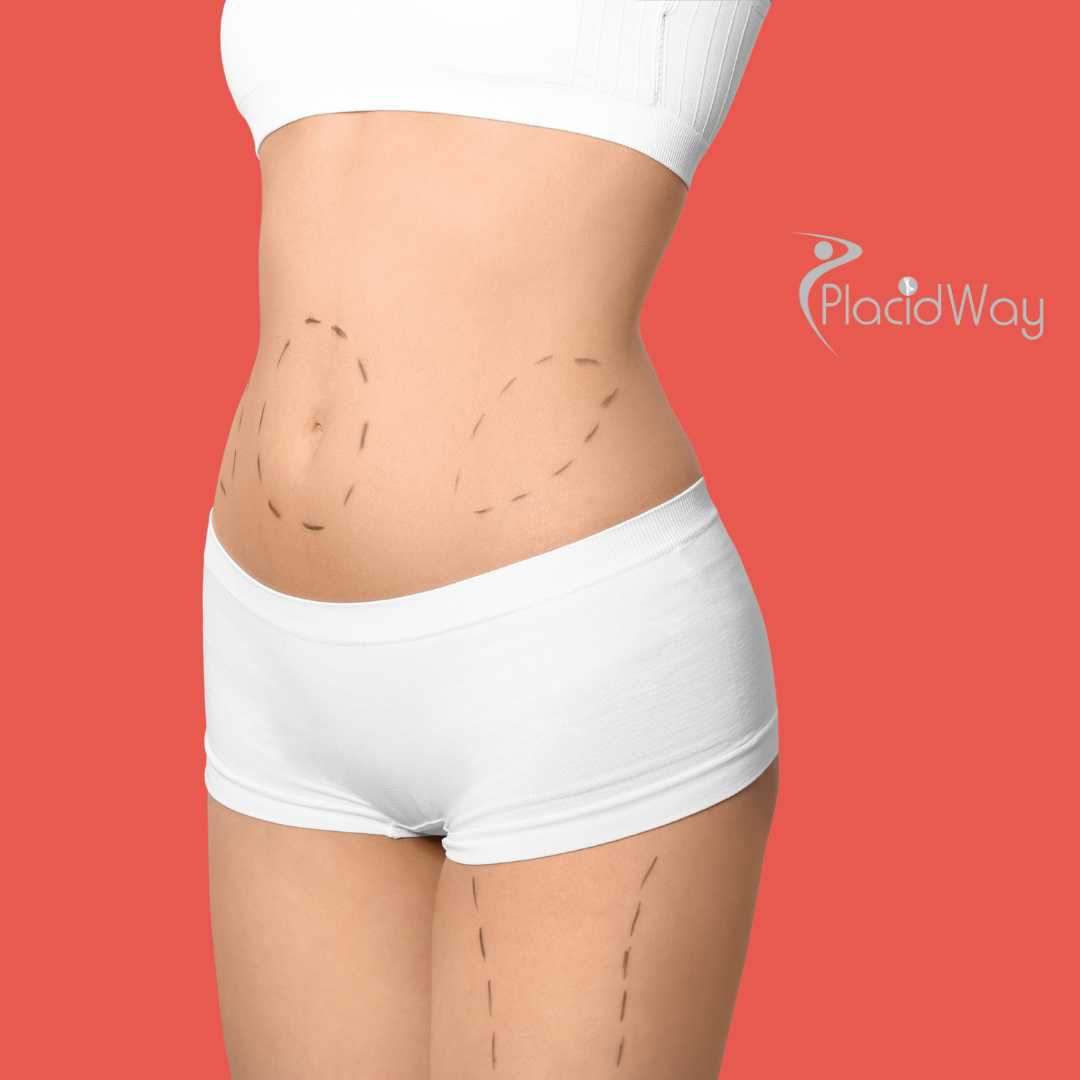 Cambio de imagen para mamás en Izmir, Turquía