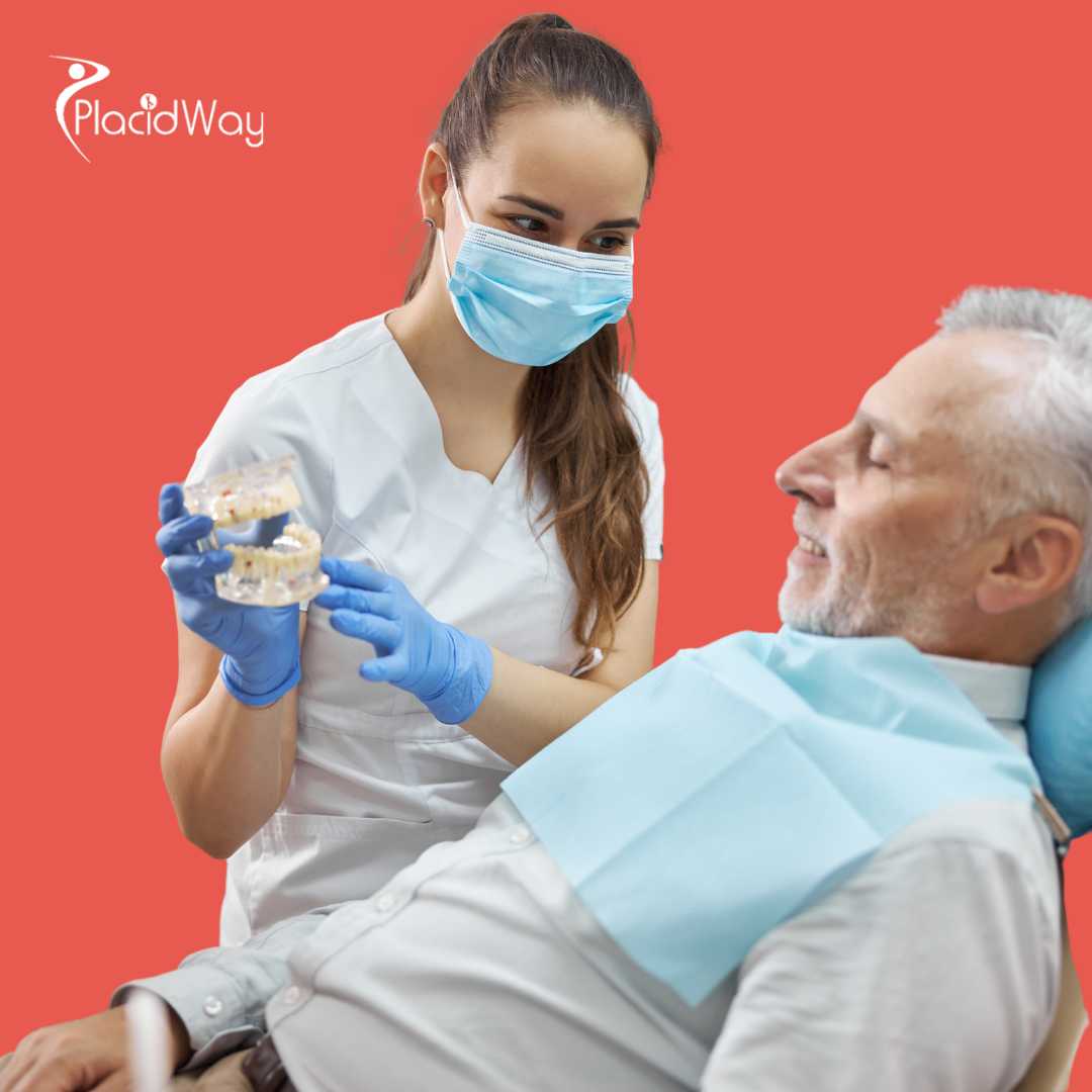 Todo sobre 4 Implantes Dentales en Los Algodones, México 