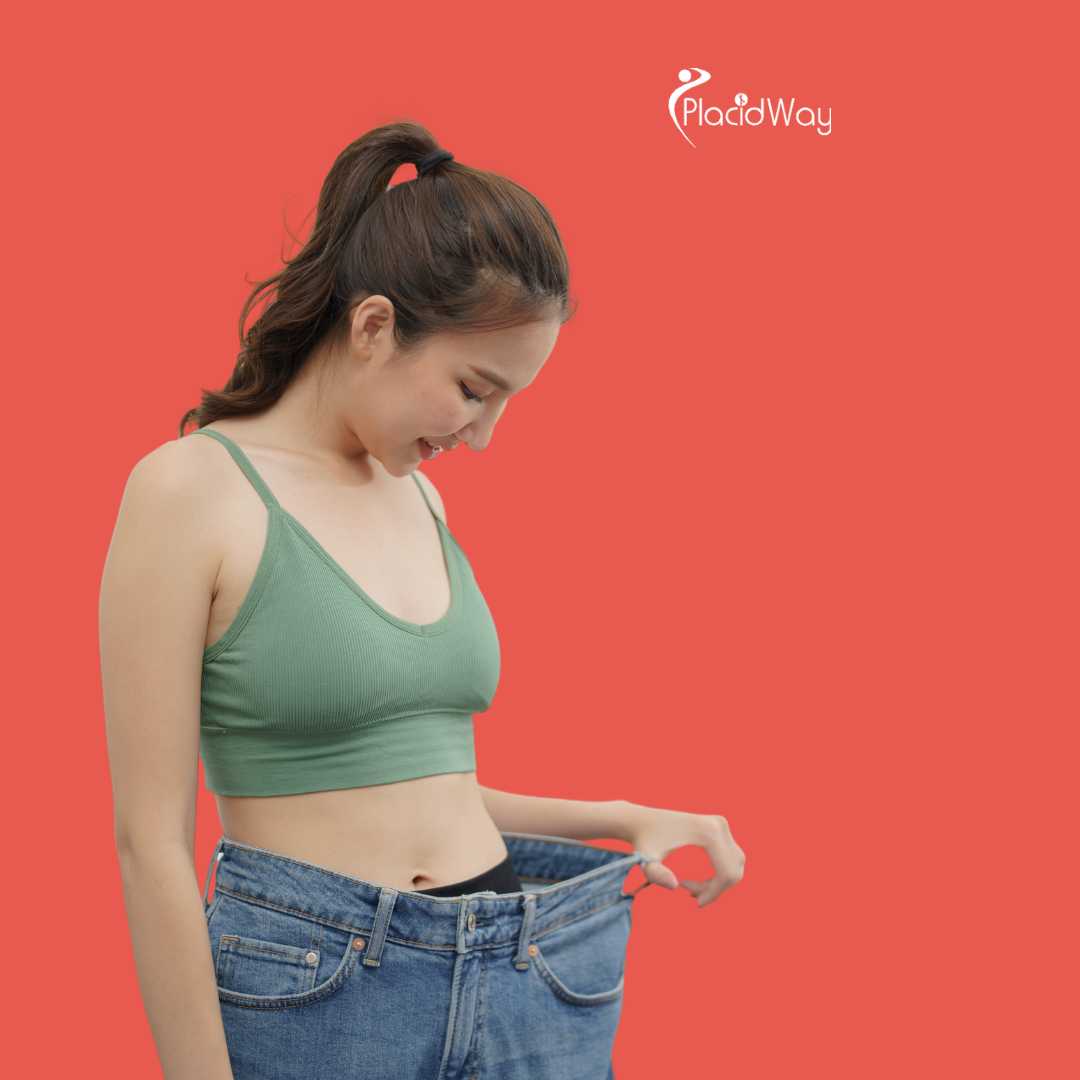 Cirugía de Manga Gástrica en Mérida, México