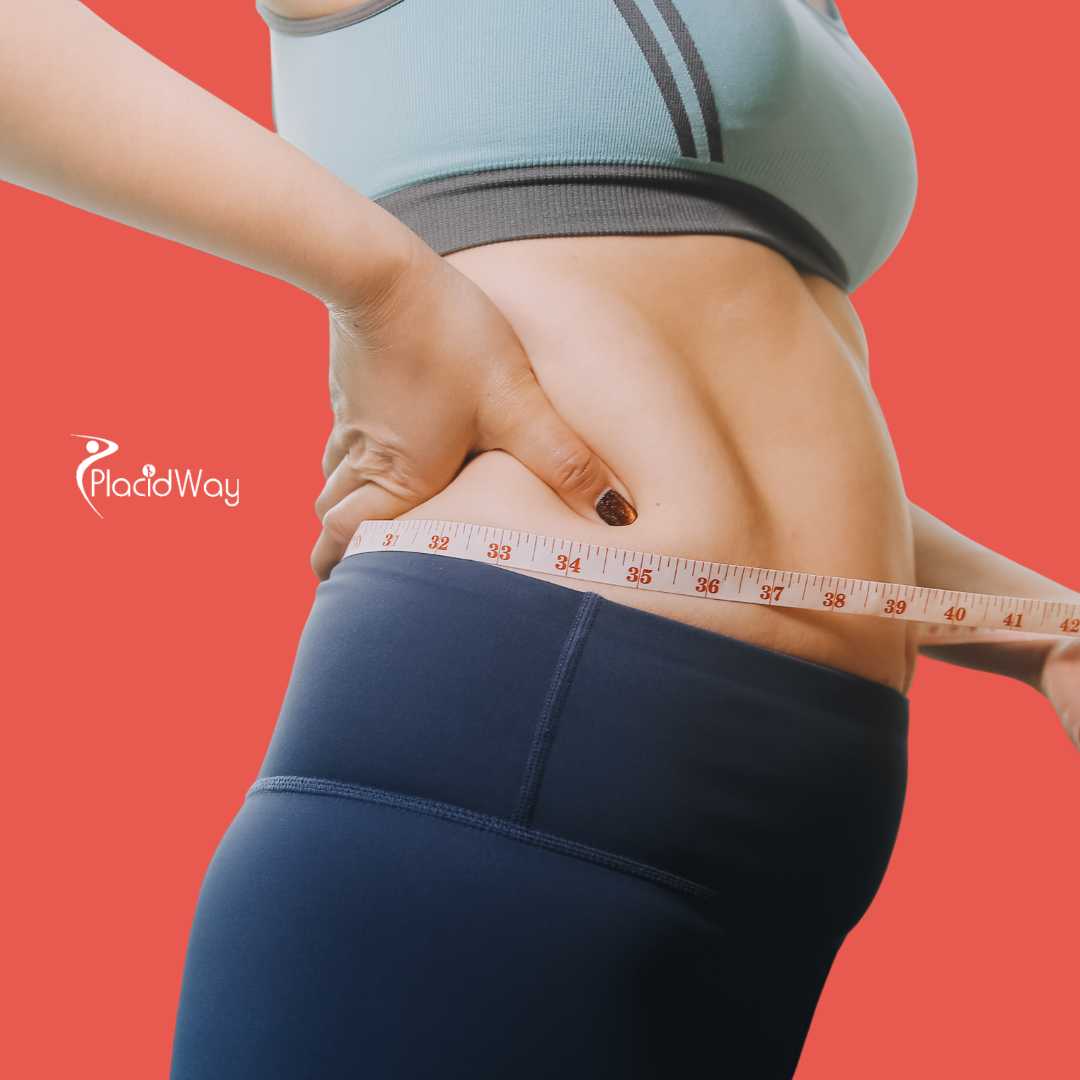 Cirugía de cruce duodenal en Cancún, México