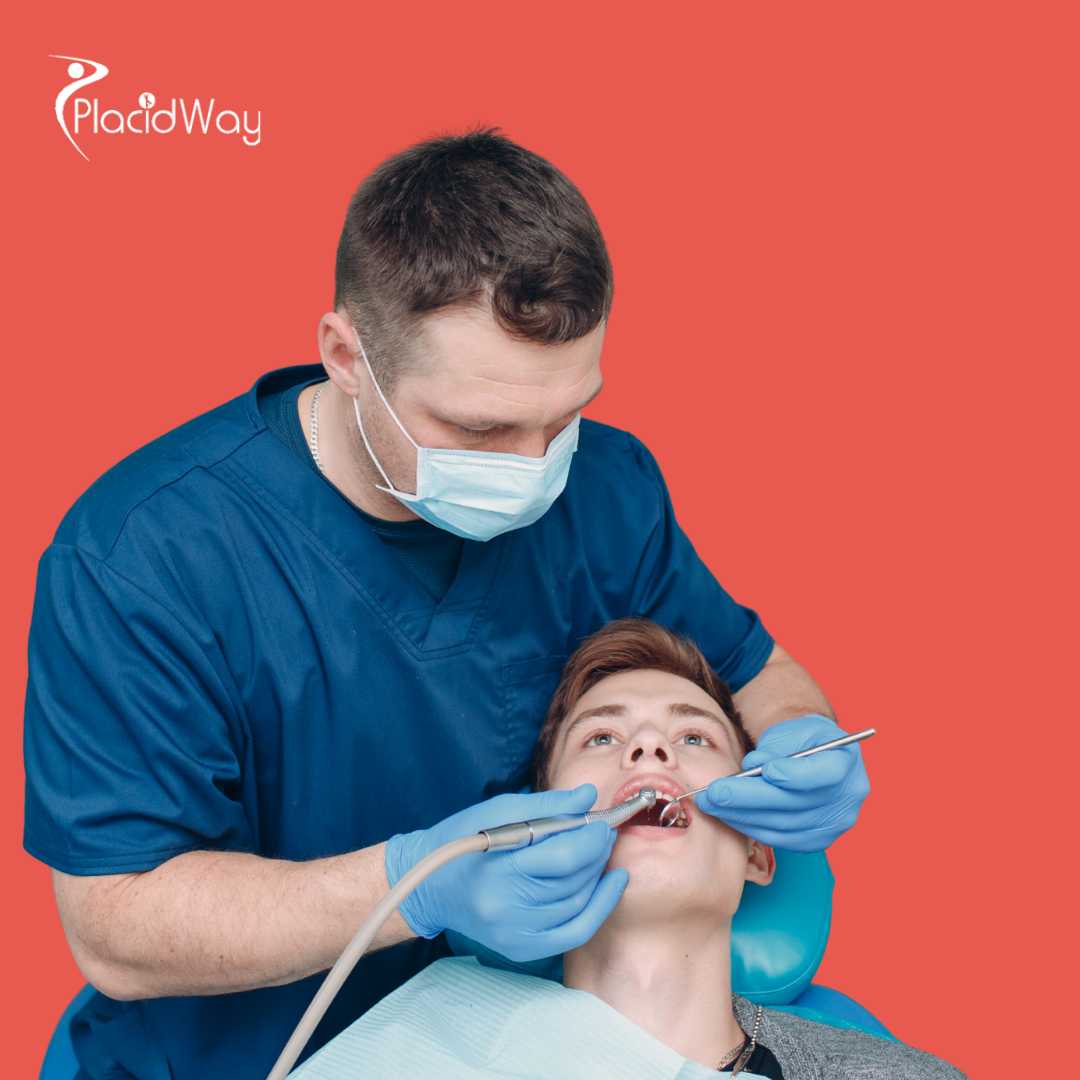 Implantes dentales All on 4 en Antalya