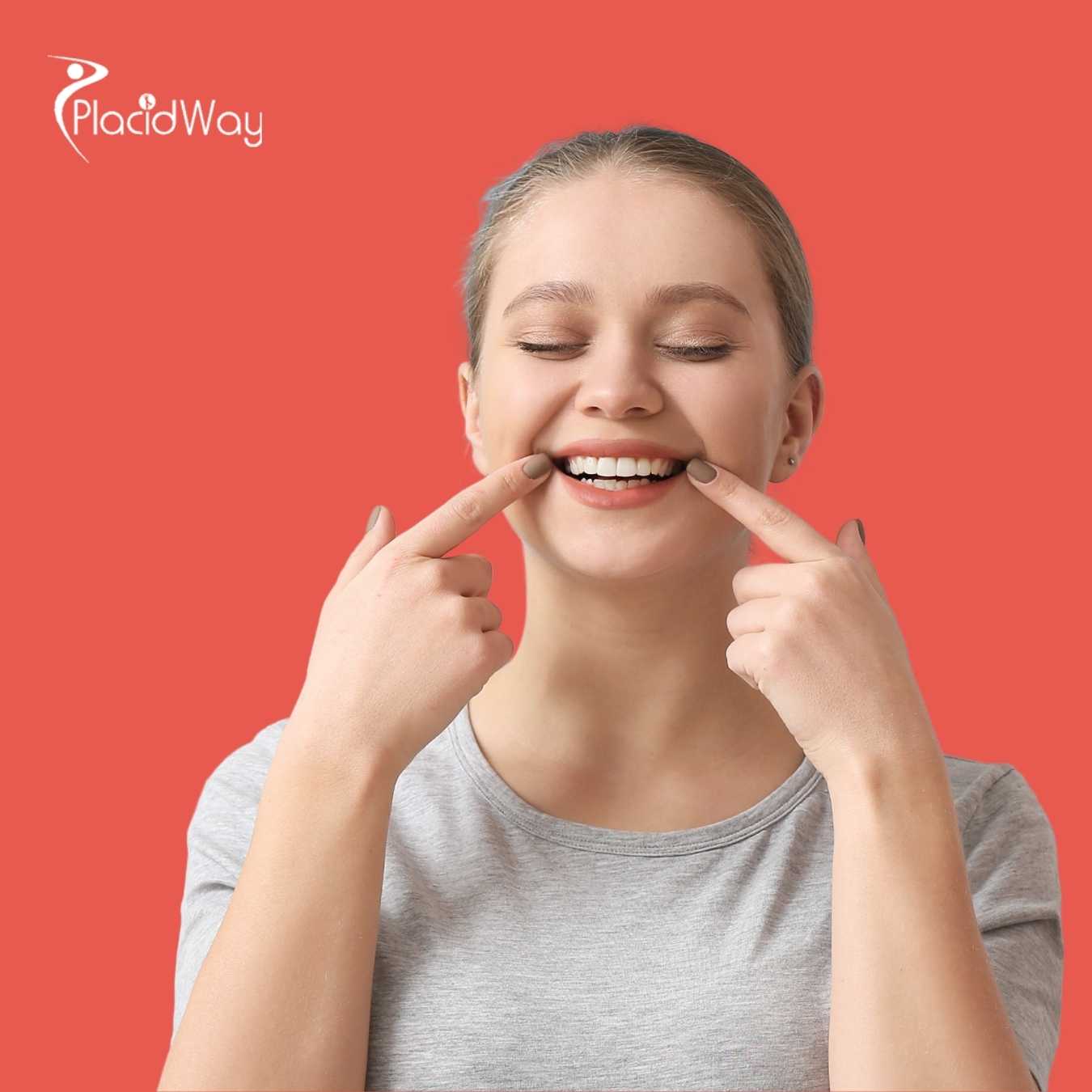 Implantes dentales de boca completa en Turquía: asequibles y seguros