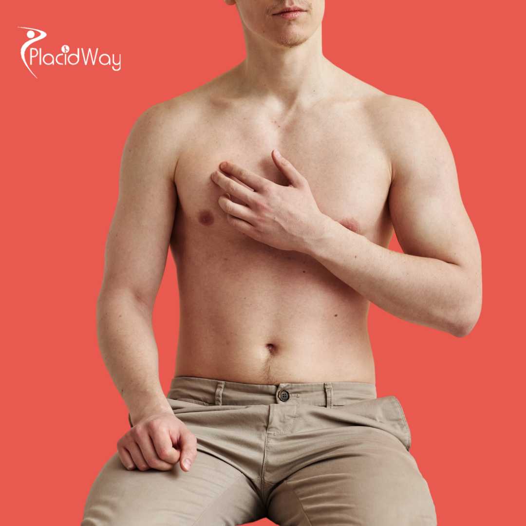 Ginecomastia Guadalajara, México