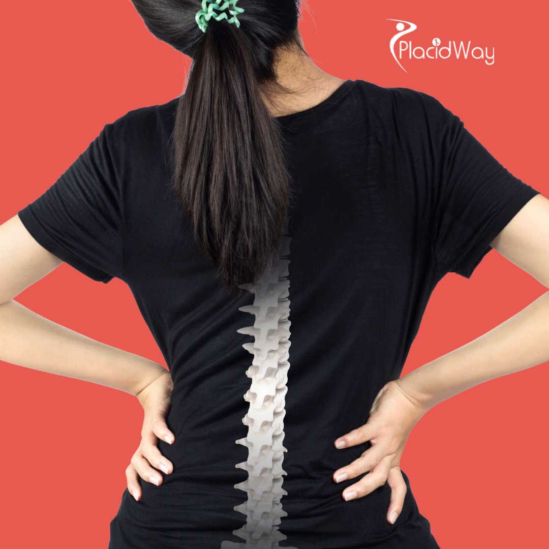 Cirugía de columna en Ankara, Turquía